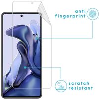 imoshion Screenprotector Folie 3 pack Xiaomi 11T (Pro)